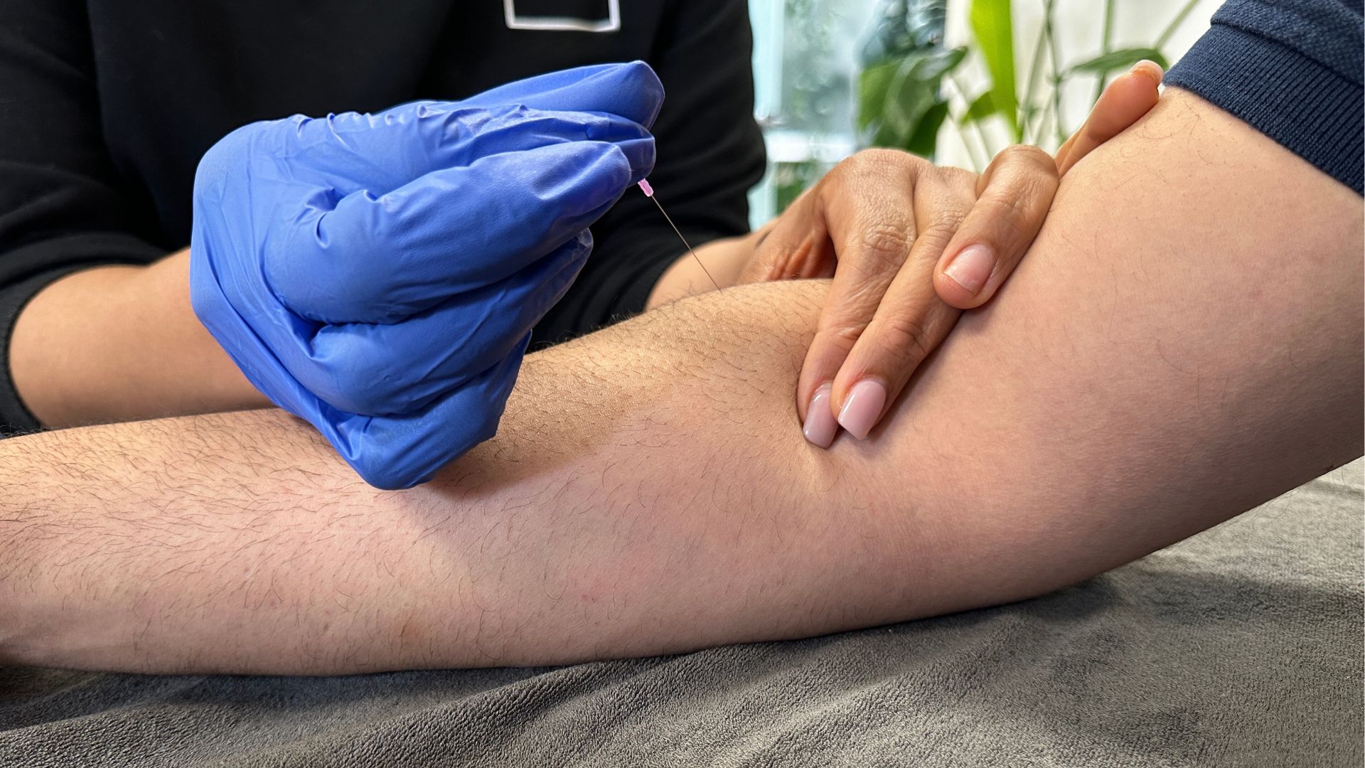 Dry needling behandeling onderarm Hoofddorp door gecertificeerd fysiotherapeut